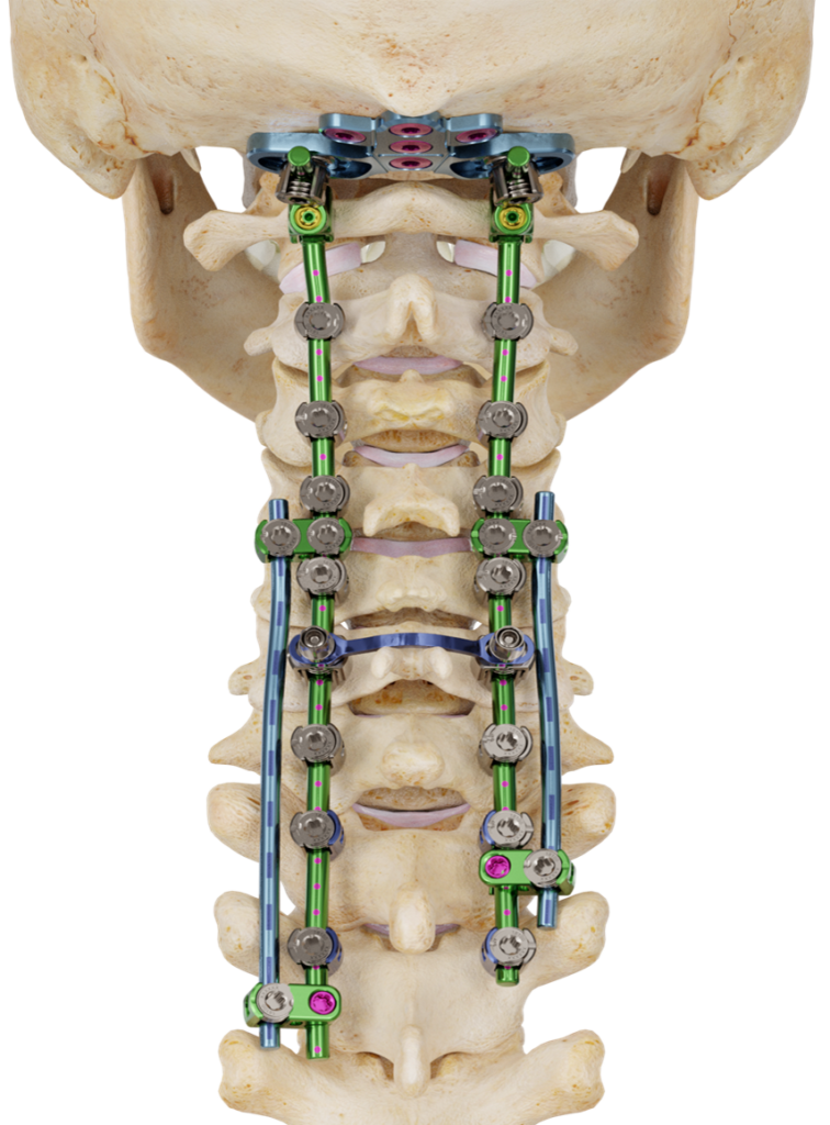 Invictus-OCT - ATEC Spine