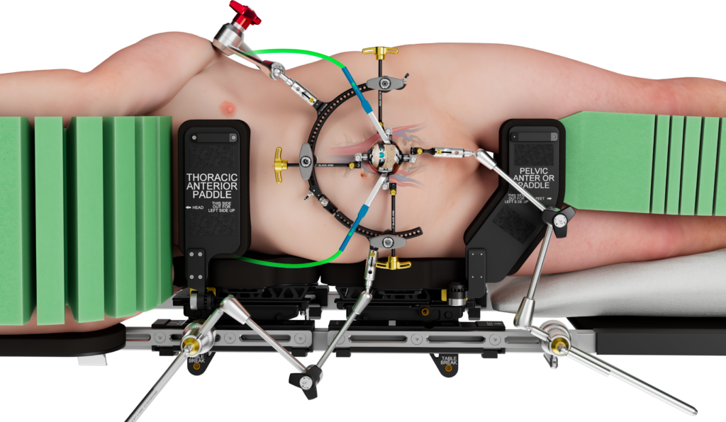 Sigma™ ALIF - ATEC Spine