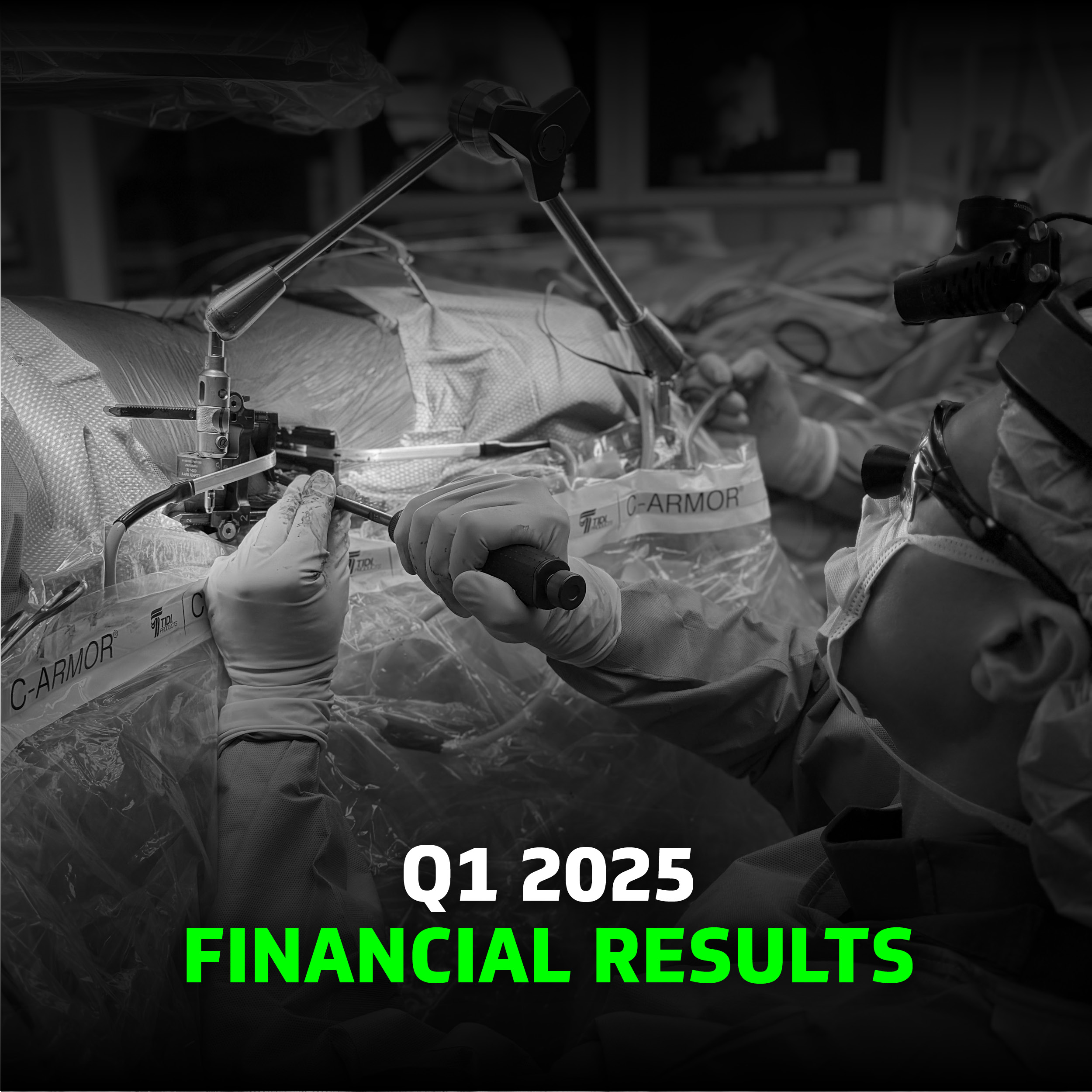 Q1 25 Results Q1 25 Results